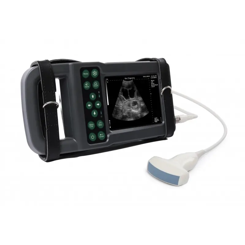 Ultrazvukový skener KX5600L s digitální abdominální sondou Vrácení Zdarma